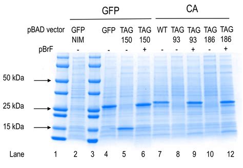 how to read sds page|Protein Electrophoresis Using SDS.